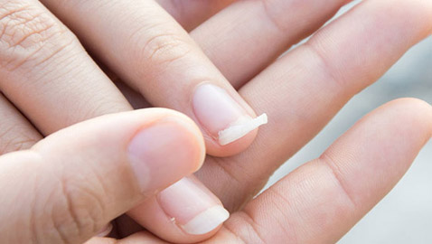 ما هو  السبب الحقيقي وراء تقصف الأظافر؟!