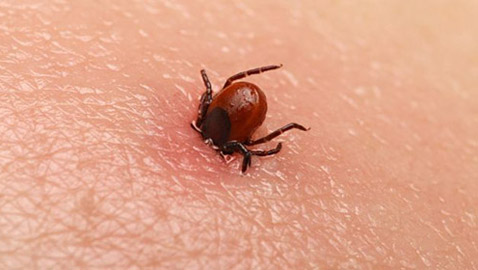 طرق سهلة لمعالجة لدغات الحشرات