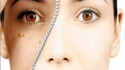 هكذا تتخلصين من البقع البنية التي يتركها الصيف على بشرتك