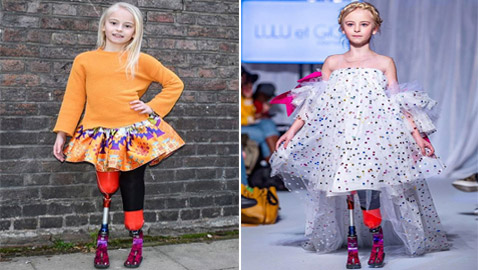 صور: طفلة مبتورة الساقين تشارك في عرض أزياء بأسبوع الموضة