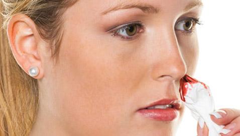 نزيف الأنف المفاجئ.. ما هي أسبابه وطريقة علاجه؟