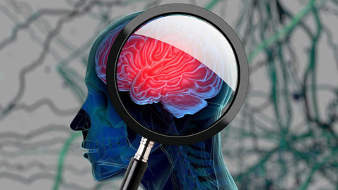 دراسة: بروتين طبيعي في أدمغتنا يحمينا من مرض ألزهايمر!