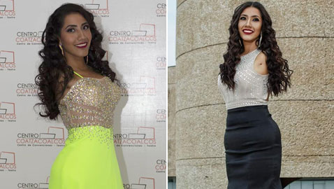 عارضة أزياء بلا ذراعين تتحدى مفاهيم الجمال