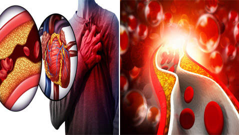 أبرز الخرافات والشائعات المنتشرة عن الكوليسترول التي يصدقها الكثيرون