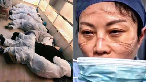 مشاهد مؤثرة لأطباء صينيين.. هيستيريا وانهيارات عصبية وأيام بلا نوم!