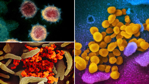 أول صور مجهرية مفصلة لفيروس كورونا القاتل!