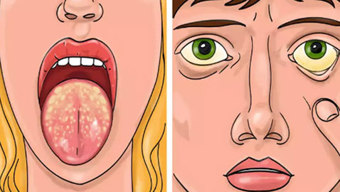 10 أمراض خفية تتنكر في صورة أزمات صحية أخرى