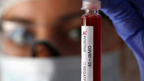 الأبحاث تكشف فصيلة الدم الأكثر عرضة لخطر كورونا