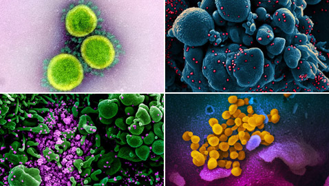 بالصور: شاهدوا فيروس كورونا (كوفيد 19) بعدسة المجهر