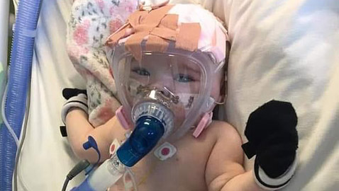 صور موجعة.. رضيعة بريطانية مريضة بالقلب تصاب بفيروس كورونا!