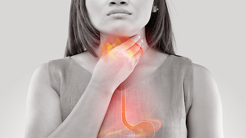 علاج حرقة المعدة والحموضة في رمضان.. ما أسبابها الرئيسية؟