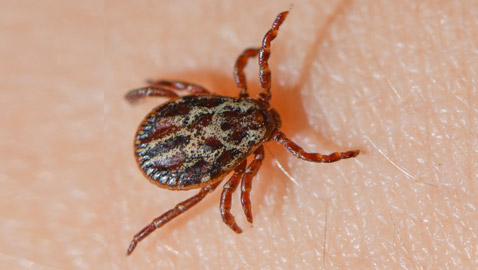 أعراض تشبه مرض كورونا.. والسبب لدغة حشرة القراد!