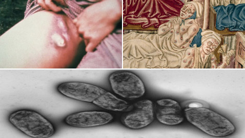 بعد كورونا وإنفلونزا الخنازير.. تحذير من تفشي الطاعون الأسود القادم!