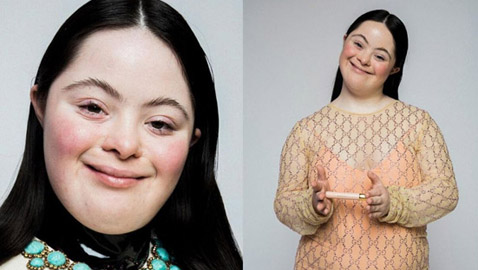 لأول مرة عارضة أزياء بمتلازمة داون تظهر على صفحات مجلة فوغ