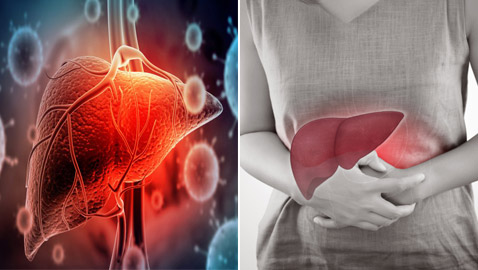 إليك كل ما تريد معرفته عن التهاب الكبد وأنواعه وأسبابه وأعراضه!