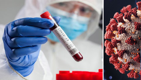 شاب يصاب بفيروس كورونا مرتين والعدوى الثانية أكثر وأشد خطورة!