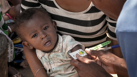 10 آلاف طفل قد يموتون شهريا من سوء التغذية نتيجة كورونا