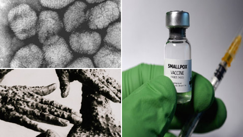 الجدري: المرض الفتاك الذي قتل الملايين وأدى لظهور أول لقاح في العالم
