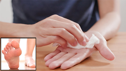 أسباب تعرّق القدمين واليدين.. كيف تسيطر على هذه الظاهرة وتعالجها؟