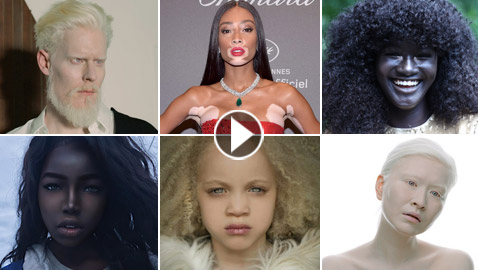 جمالهم غير طبيعي: تعرفوا إلى شخصيات تميزت بلون بشرة نادر غير مألوف