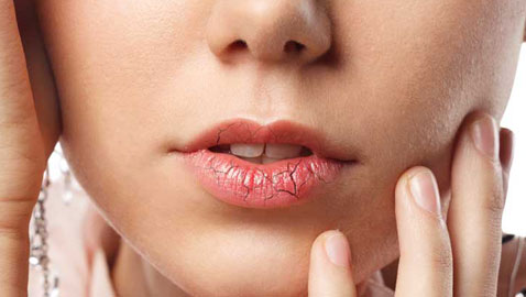 مكوّنات طبيعيّة تساعدك في حل مشكلة تشقّق الشفاه