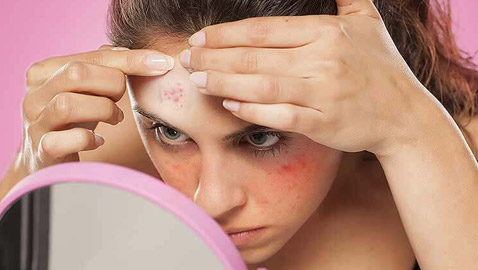 تعاني من بثور الوجه؟ إليك الدليل الشامل لأنواعها وأسبابها وعلاجاتها
